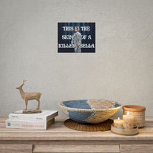 Load image into Gallery viewer, Skin of a Killer Print
